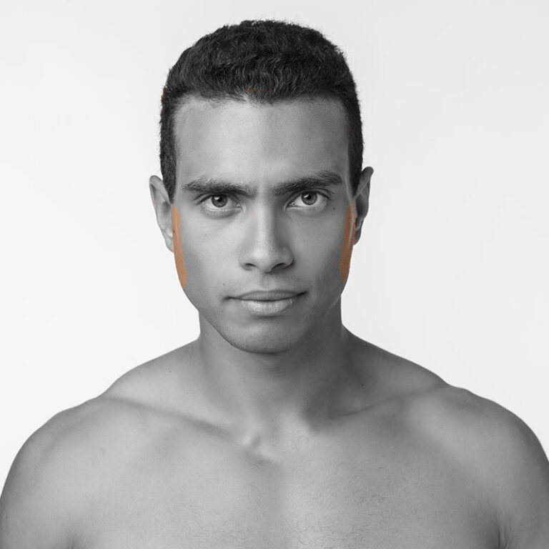 Épilation laser favoris CLINIQUE SKINS