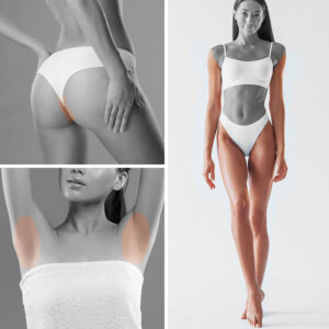 Épilation laser forfait D - Aisselles, bikini complet, jambes & bras complets